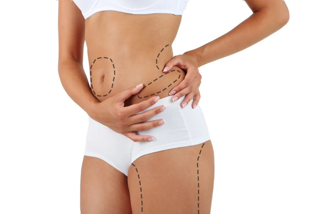 Antalya liposuction Dr Gökhan Özerdem